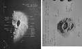 Thumbnail for version as of 19:13, 1 January 2015
